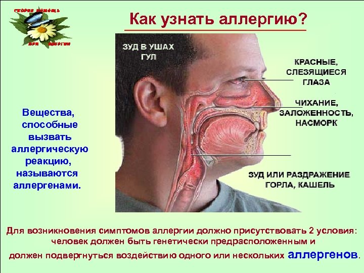 Как узнать аллергию? Вещества, способные вызвать аллергическую реакцию, называются аллергенами. Для возникновения симптомов аллергии