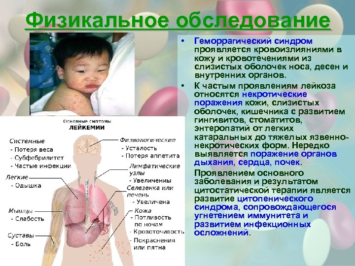 Физикальное обследование • • • Геморрагический синдром проявляется кровоизлияниями в кожу и кровотечениями из