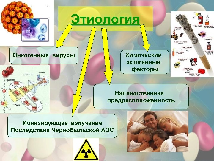 Этиология Химические экзогенные факторы Онкогенные вирусы Наследственная предрасположенность Ионизирующее излучение Последствия Чернобыльской АЭС 