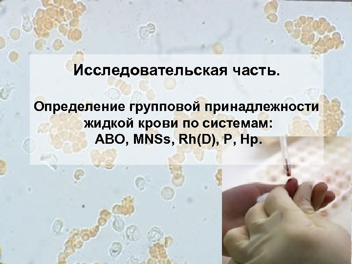 Исследовательская часть. Определение групповой принадлежности жидкой крови по системам: ABO, MNSs, Rh(D), Р, Hp.