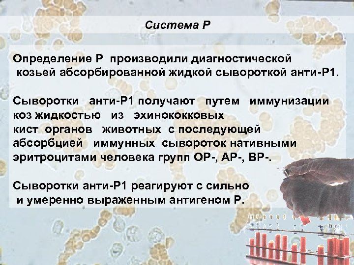 Система Р Определение Р производили диагностической козьей абсорбированной жидкой сывороткой анти-P 1. Сыворотки анти-P