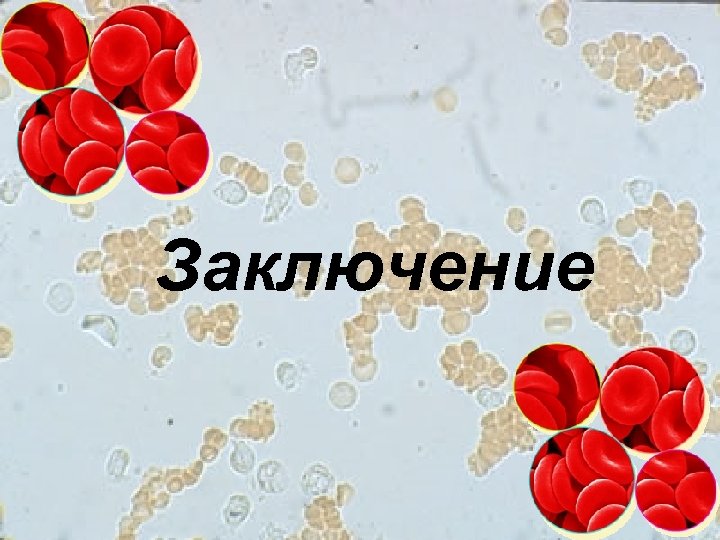 Заключение 