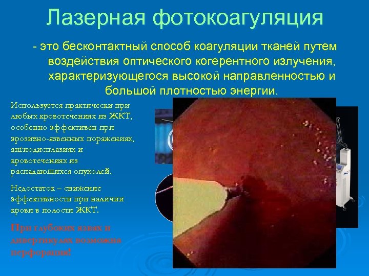 Лазерная фотокоагуляция - это бесконтактный способ коагуляции тканей путем воздействия оптического когерентного излучения, характеризующегося