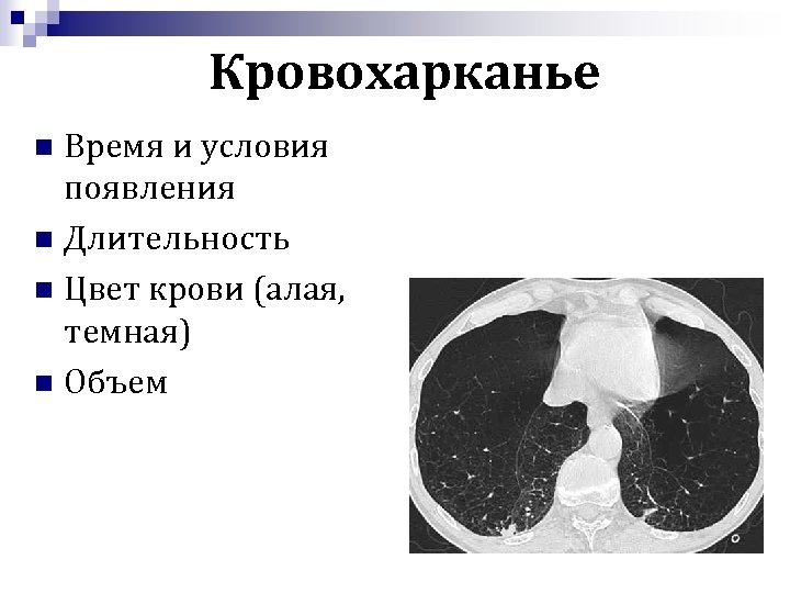 Кровохарканье Время и условия появления n Длительность n Цвет крови (алая, темная) n Объем