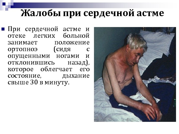 Жалобы при сердечной астме n При сердечной астме и отеке легких больной занимает положение