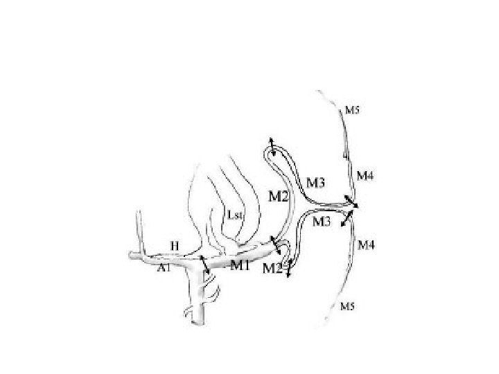 Vascular anatomy of the insula and LSAs 