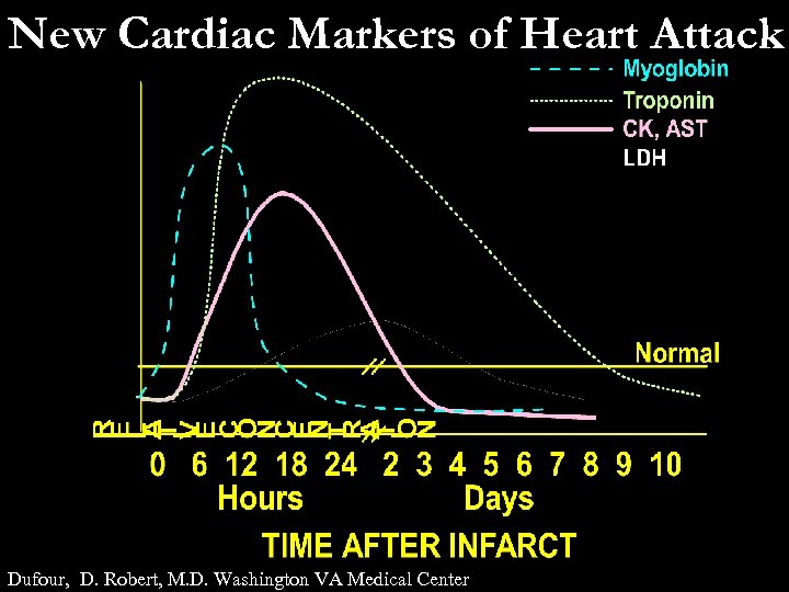 New Cardiac Markers of Heart Attack Dufour, D. Robert, M. D. Washington VA Medical