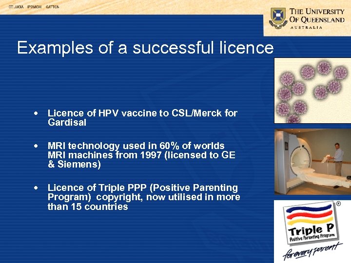 Examples of a successful licence Licence of HPV vaccine to CSL/Merck for Gardisal MRI