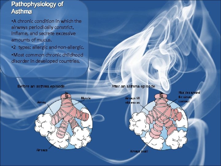 Pathophysiology of Asthma • A chronic condition in which the airways periodically constrict, inflame,