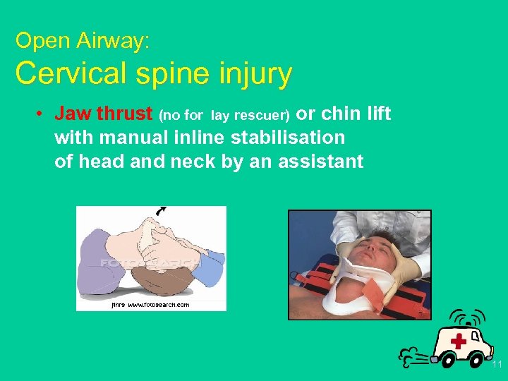 Open Airway: Cervical spine injury • Jaw thrust (no for lay rescuer) or chin