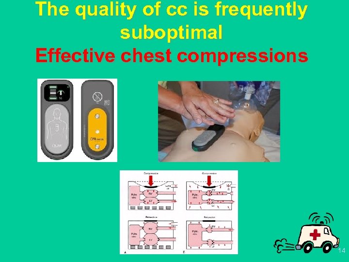 The quality of cc is frequently suboptimal Effective chest compressions 14 