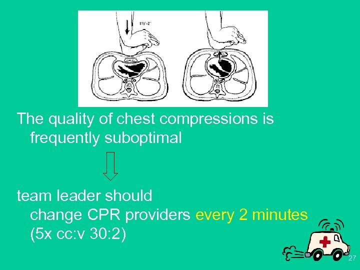 The quality of chest compressions is frequently suboptimal team leader should change CPR providers