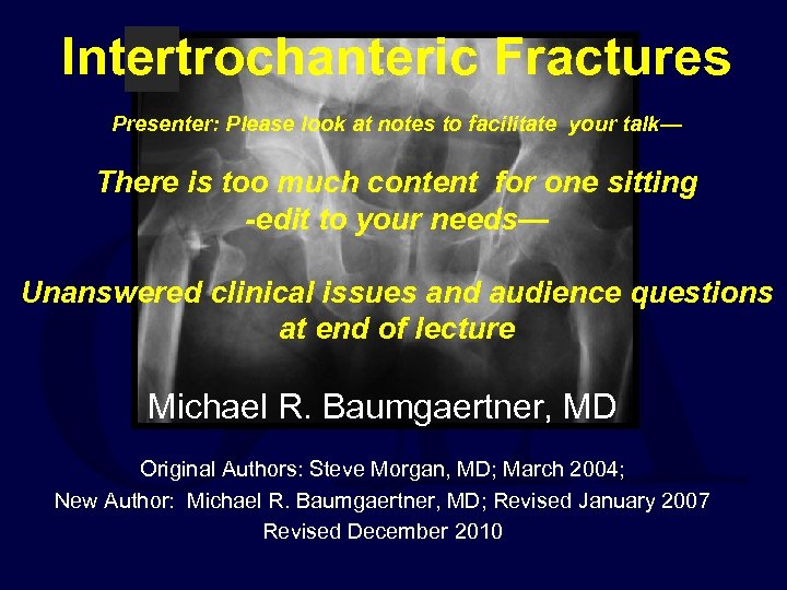 Intertrochanteric Fractures Presenter: Please look at notes to facilitate your talk— There is too