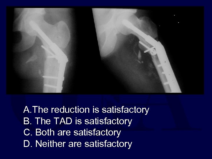 A. The reduction is satisfactory B. The TAD is satisfactory C. Both are satisfactory