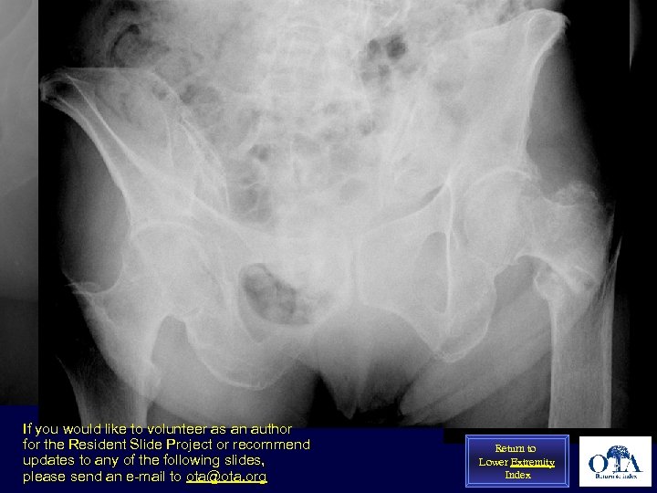 If you would like to volunteer as an author for the Resident Slide Project