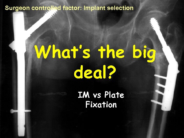 Surgeon controlled factor: Implant selection What’s the big deal? IM vs Plate Fixation 