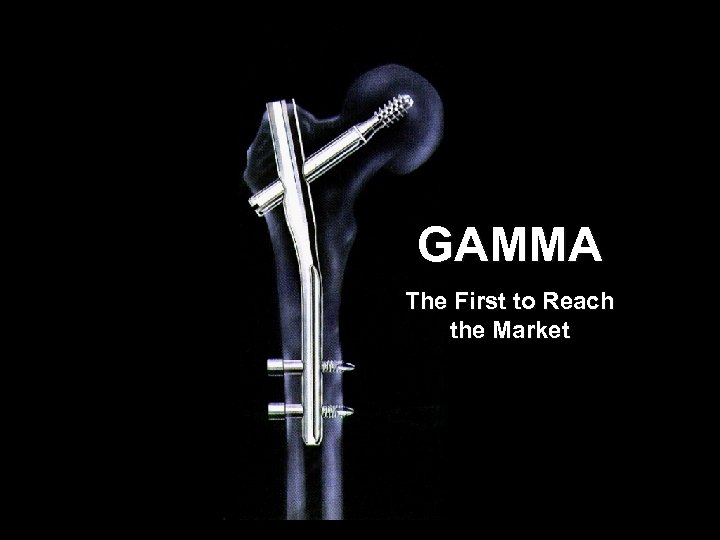 GAMMA The First to Reach the Market 
