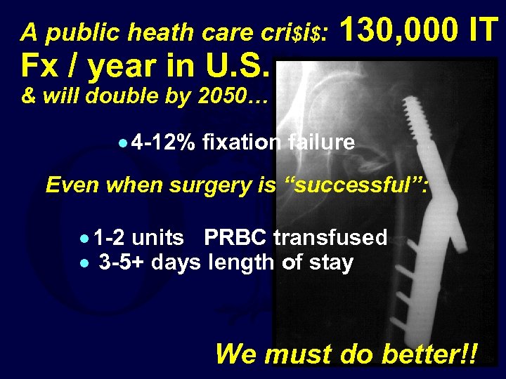 A public heath care cri$i$: Fx / year in U. S. 130, 000 IT
