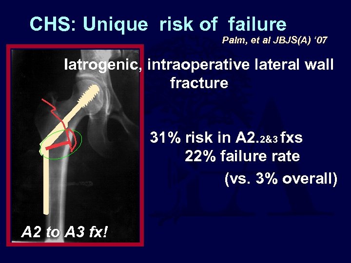 CHS: Unique risk of failure Palm, et al JBJS(A) ‘ 07 Iatrogenic, intraoperative lateral