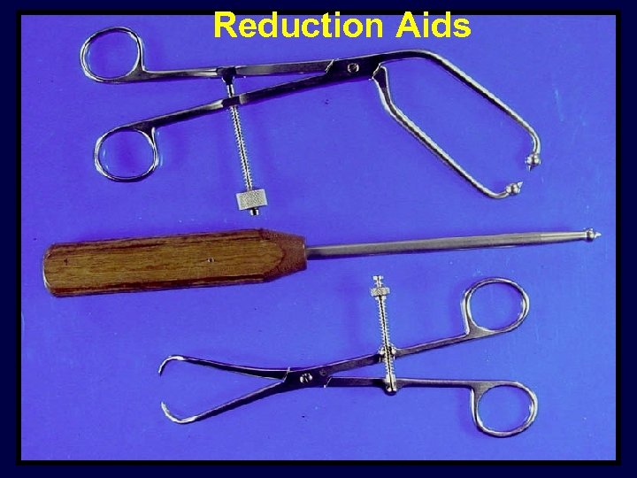 Reduction Aids 