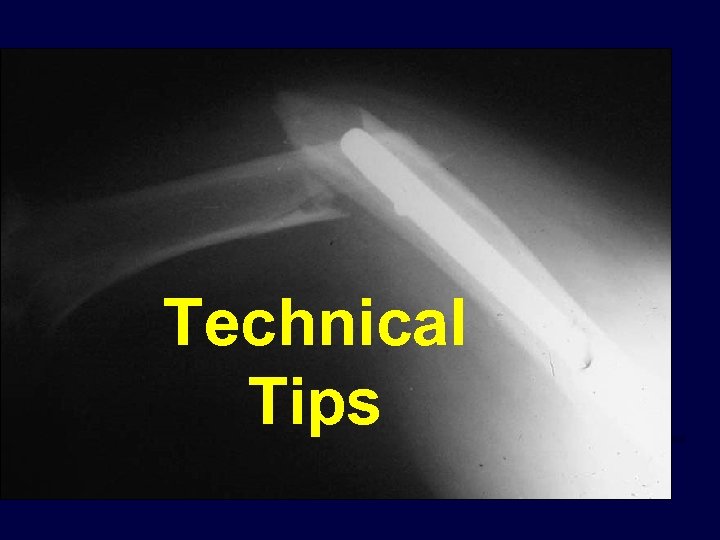 Technical Tips 