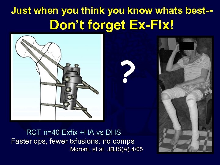Just when you think you know whats best-- Don’t forget Ex-Fix! ? RCT n=40