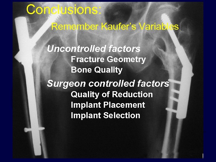 Conclusions: Remember Kaufer’s Variables Uncontrolled factors Fracture Geometry Bone Quality Surgeon controlled factors Quality