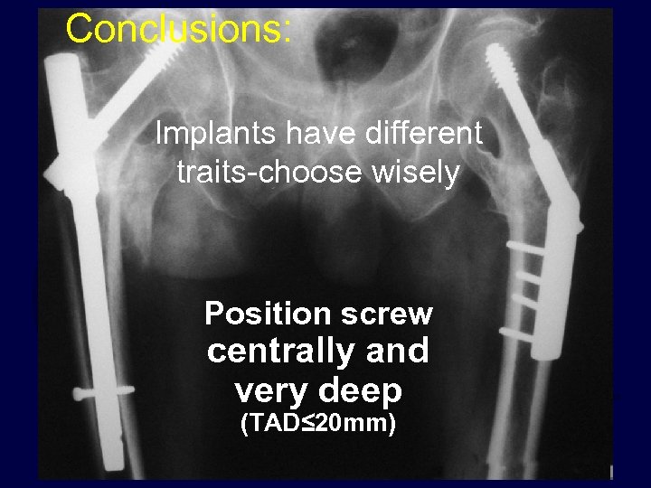 Conclusions: Implants have different traits-choose wisely Position screw centrally and very deep (TAD≤ 20