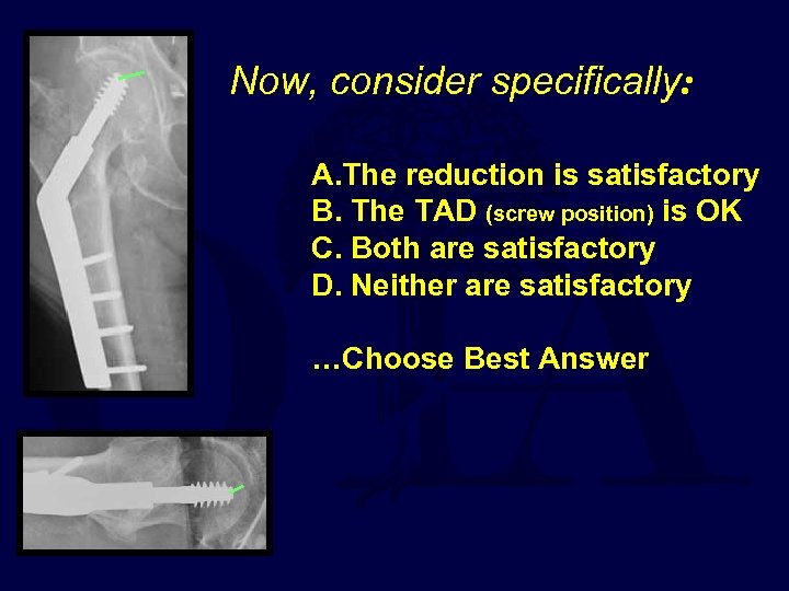 Now, consider specifically: A. The reduction is satisfactory B. The TAD (screw position) is