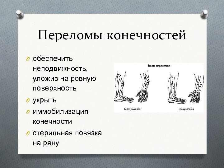 Переломы конечностей O обеспечить неподвижность, уложив на ровную поверхность O укрыть O иммобилизация конечности
