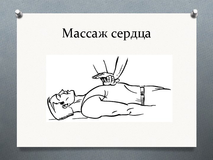 Массаж сердца 