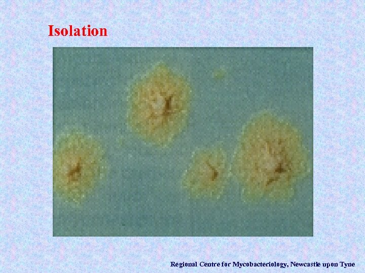 Isolation Regional Centre for Mycobacteriology, Newcastle upon Tyne 