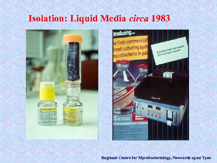 Isolation: Liquid Media circa 1983 Regional Centre for Mycobacteriology, Newcastle upon Tyne 