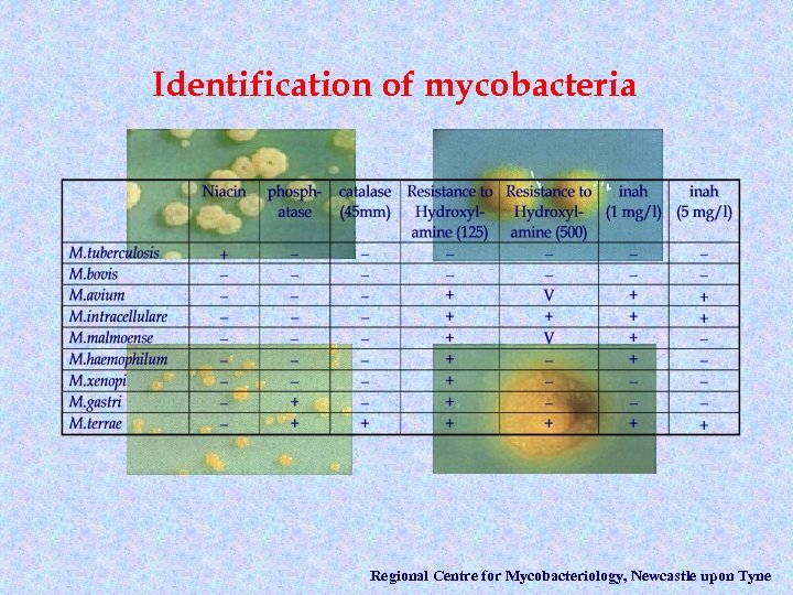 Identification of mycobacteria Regional Centre for Mycobacteriology, Newcastle upon Tyne 