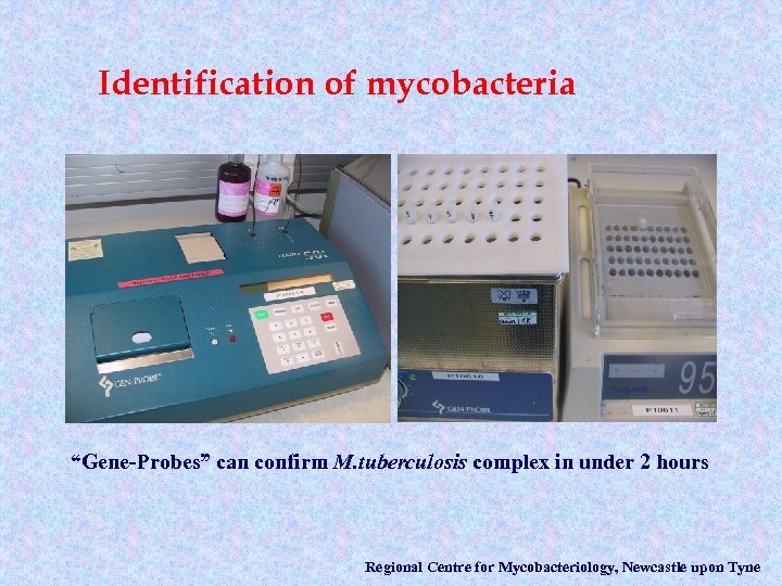 Identification of mycobacteria “Gene-Probes” can confirm M. tuberculosis complex in under 2 hours Regional
