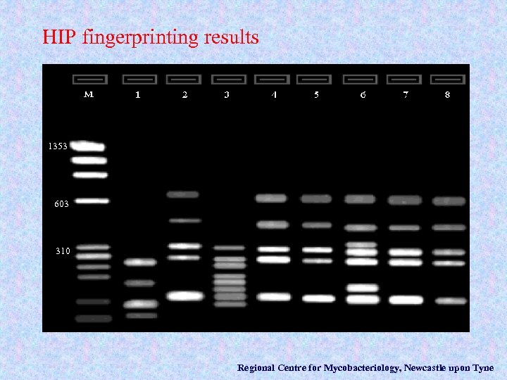 HIP fingerprinting results 1353 603 310 Regional Centre for Mycobacteriology, Newcastle upon Tyne 
