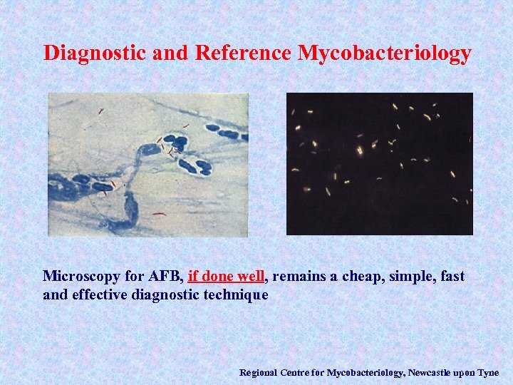 Diagnostic and Reference Mycobacteriology Microscopy for AFB, if done well, remains a cheap, simple,