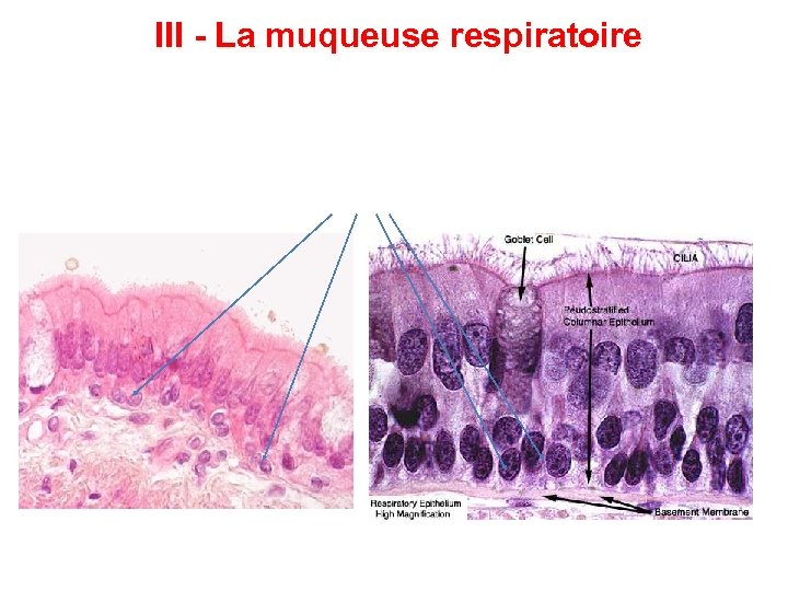 III - La muqueuse respiratoire 