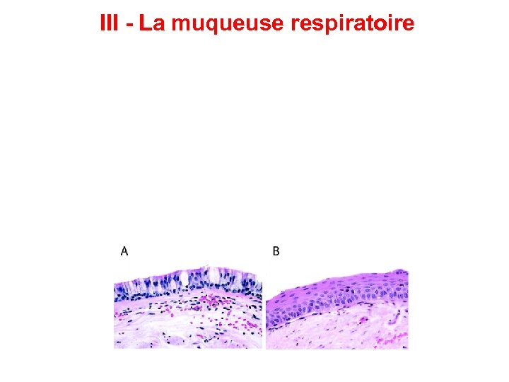 III - La muqueuse respiratoire 