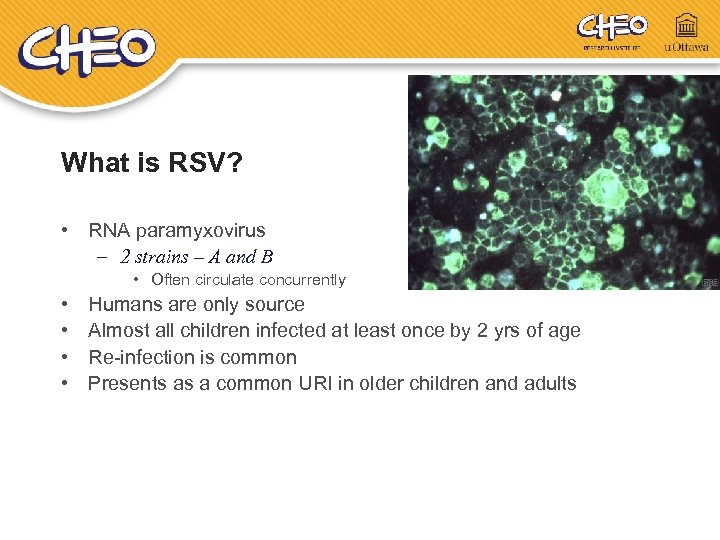 What is RSV? • RNA paramyxovirus – 2 strains – A and B •