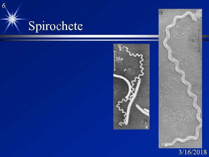 6 Spirochete 3/16/2018 