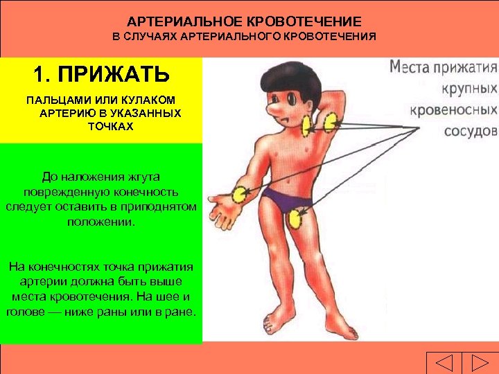 АРТЕРИАЛЬНОЕ КРОВОТЕЧЕНИЕ В СЛУЧАЯХ АРТЕРИАЛЬНОГО КРОВОТЕЧЕНИЯ 1. ПРИЖАТЬ ПАЛЬЦАМИ ИЛИ КУЛАКОМ АРТЕРИЮ В УКАЗАННЫХ