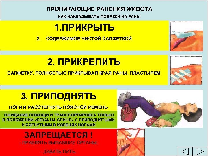 ПРОНИКАЮЩИЕ РАНЕНИЯ ЖИВОТА КАК НАКЛАДЫВАТЬ ПОВЯЗКИ НА РАНЫ 1. ПРИКРЫТЬ 2. СОДЕРЖИМОЕ ЧИСТОЙ САЛФЕТКОЙ