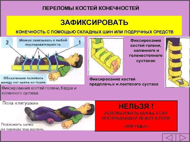 ПЕРЕЛОМЫ КОСТЕЙ КОНЕЧНОСТЕЙ ЗАФИКСИРОВАТЬ КОНЕЧНОСТЬ С ПОМОЩЬЮ СКЛАДНЫХ ШИН ИЛИ ПОДРУЧНЫХ СРЕДСТВ Фиксирование костей