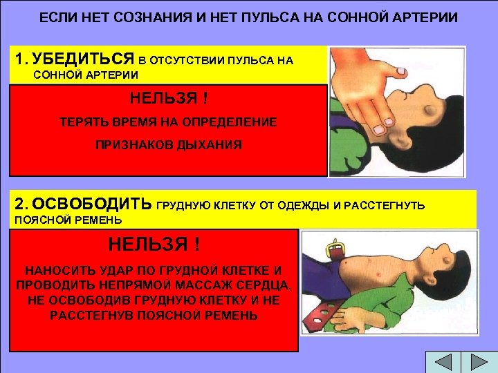 ЕСЛИ НЕТ СОЗНАНИЯ И НЕТ ПУЛЬСА НА СОННОЙ АРТЕРИИ 1. УБЕДИТЬСЯ В ОТСУТСТВИИ ПУЛЬСА