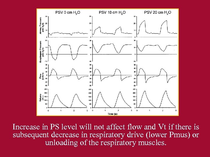 Increase in PS level will not affect flow and Vt if there is subsequent