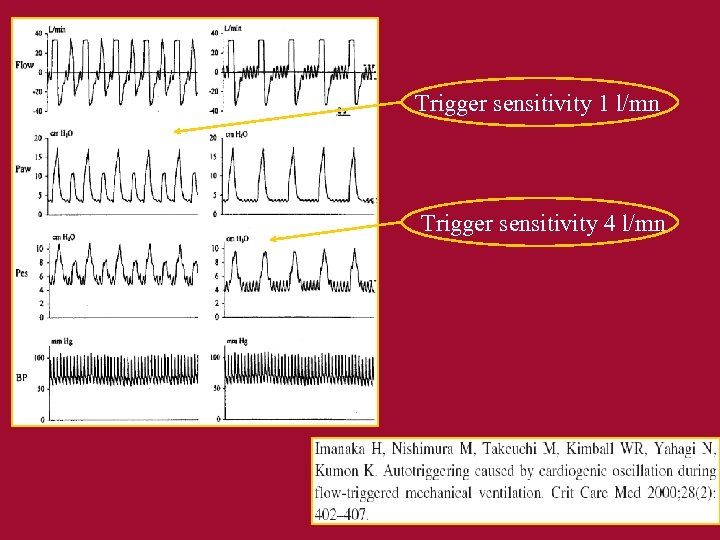 Trigger sensitivity 1 l/mn Trigger sensitivity 4 l/mn 