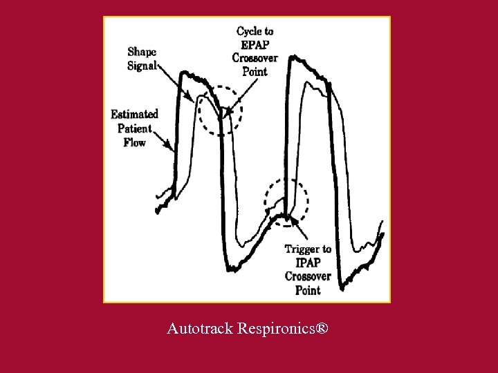 Autotrack Respironics® 