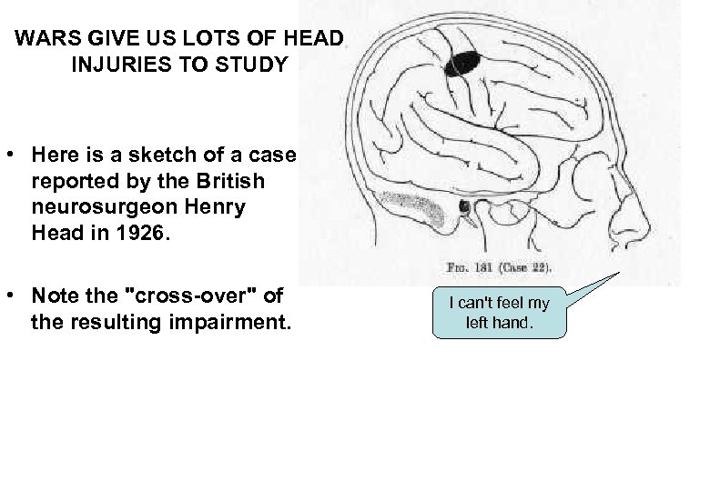 WARS GIVE US LOTS OF HEAD INJURIES TO STUDY • Here is a sketch