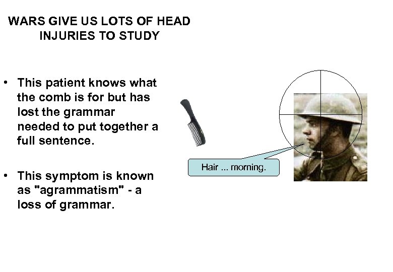 WARS GIVE US LOTS OF HEAD INJURIES TO STUDY • This patient knows what